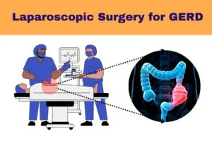 Laparoscopic surgery for GERD