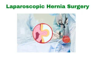 Laparoscopic hernia surgery