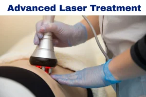 laser treatment for anal fissures