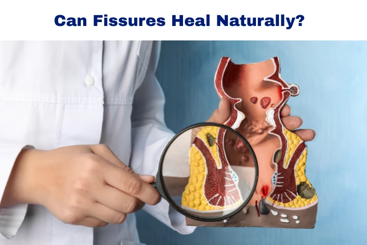 Anal fissures heal