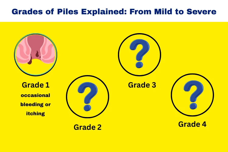 grades of piles