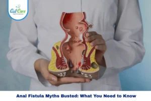 Anal Fistula Myths Busted