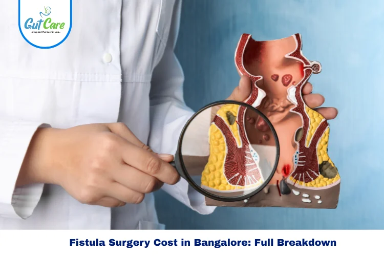 Fistula surgery cost and insurance options