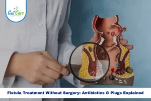 fistula plug and antibiotics as part of non-surgical anal fistula treatment