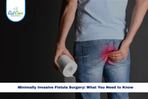 Minimally invasive fistula surgery techniques and advanced care in Bangalore.