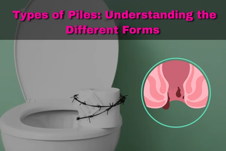 Understanding different types of piles