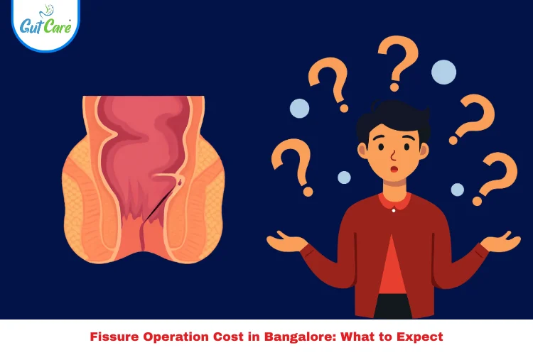 fissure operation cost