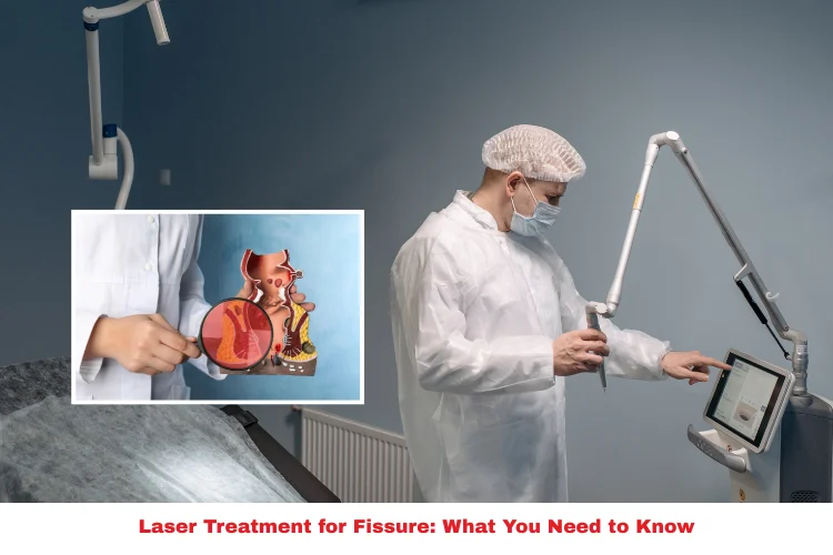 Laser Treatment for Fissure