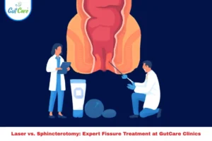 Laser vs. Sphincterotomy