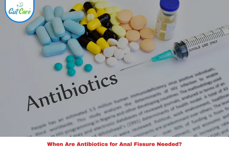 Antibiotics for Anal Fissure