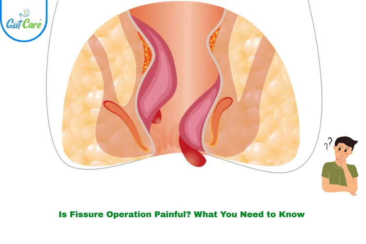 Is fissure operation painful