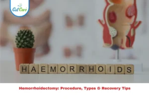 hemorrhoidectomy