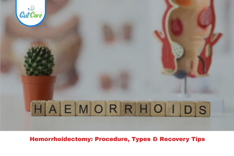 hemorrhoidectomy