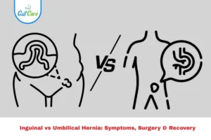 Inguinal vs Umbilical Hernia