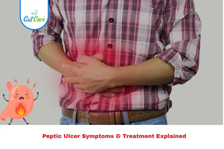 peptic ulcer