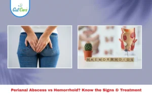 Perianal abscess vs hemorrhoids.