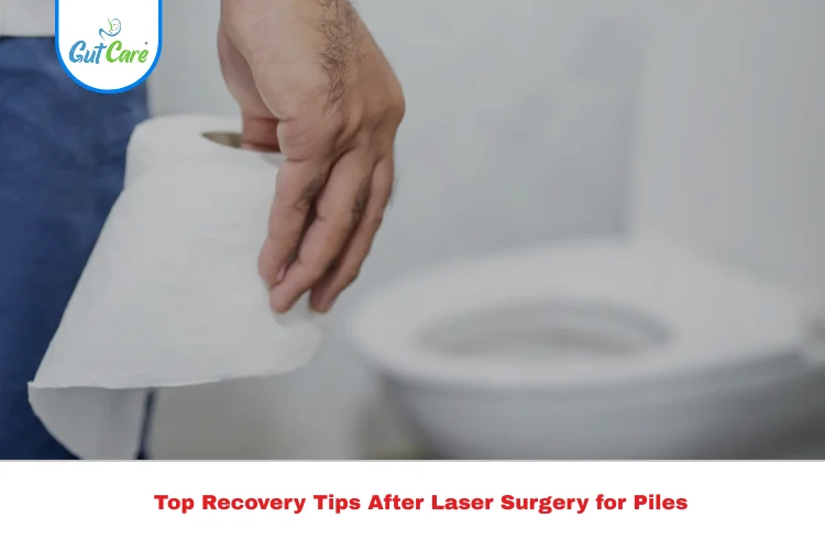 laser surgery for piles