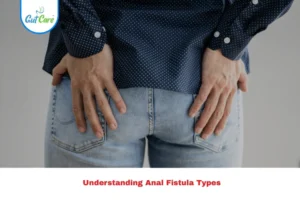anal fistula types