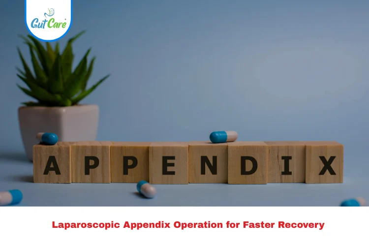 Appendix Operation