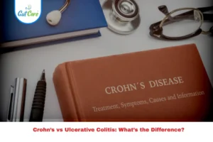 Crohn's Disease vs Ulcerative Colitis