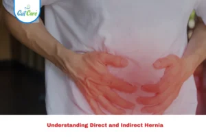 direct and indirect hernia