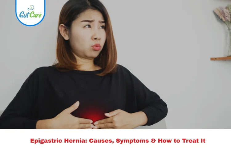 epigastric hernia