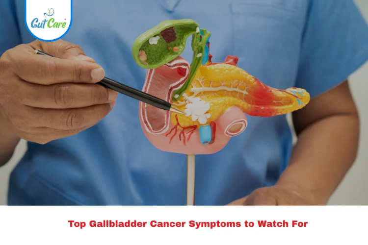 gallbladder cancer symptoms