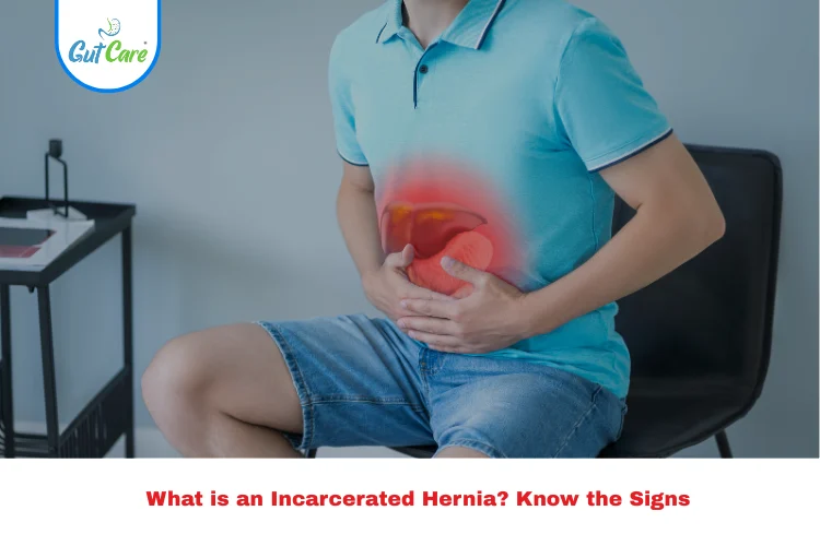 Paraumbilical Hernia