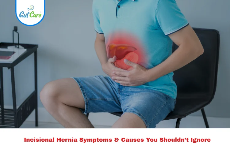 incisional hernia symptoms