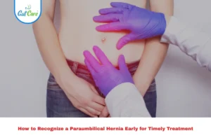 paraumbilical hernia