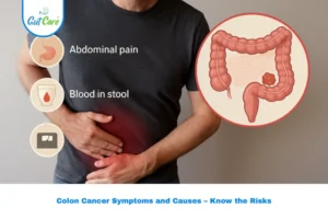 Colon Cancer Symptoms