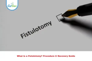 fistulotomy