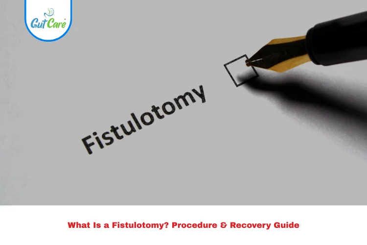 fistulotomy