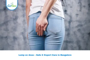 lump on anus