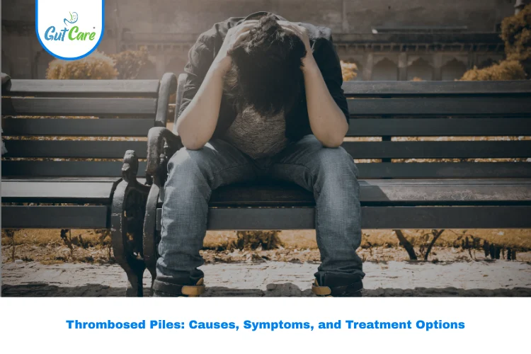 thrombosed piles