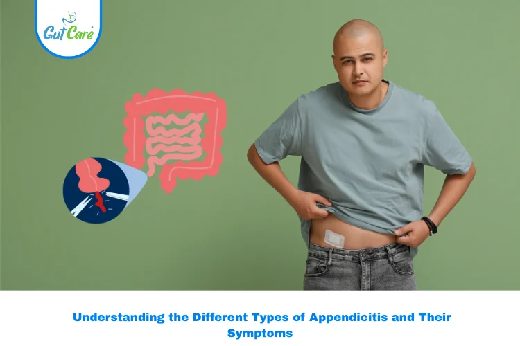types of appendicits