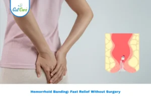 hemorrhoid banding