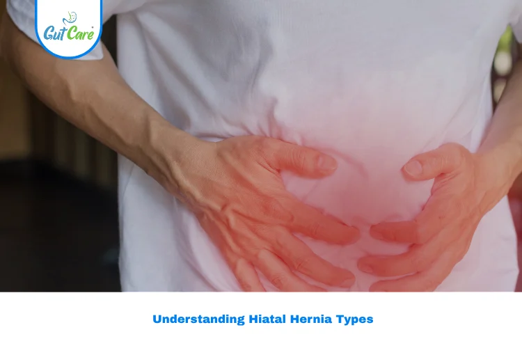 Hiatal Hernia Types