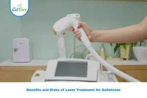 laser treatment for gallstones
