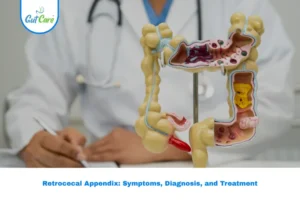 Retrocecal Appendix