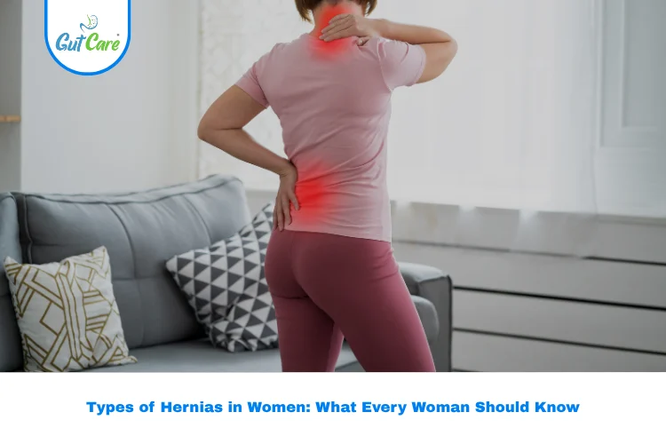 Types of Hernias in Women