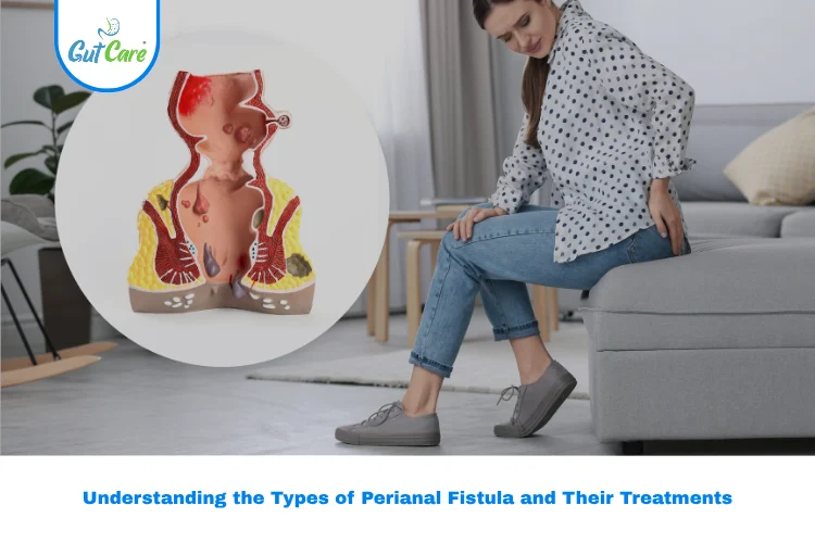 Types of Perianal Fistula