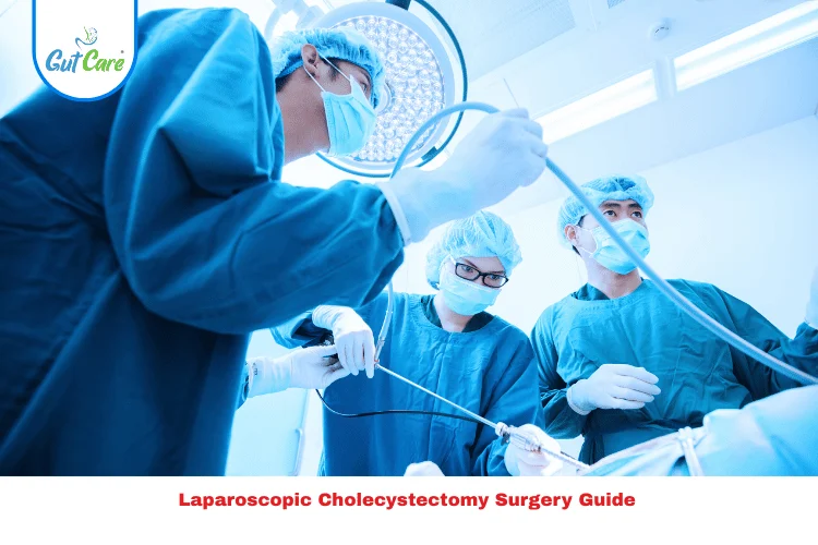 Laparoscopic Cholecystectomy Surgery