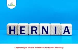 Laparoscopic Hernia Treatment
