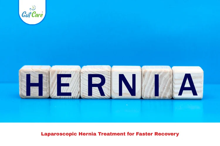 Laparoscopic Hernia Treatment