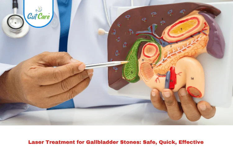 Laser Treatment for Gallbladder Stones