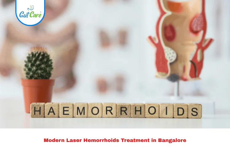 Hemorrhoids Treatment in Bangalore