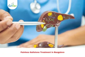 Painless Gallstone Treatment