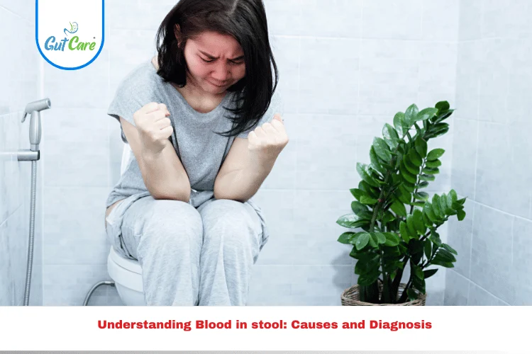 Blood in stool