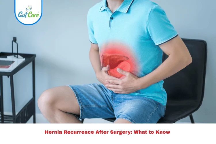 Hernia Recurrence After Surgery